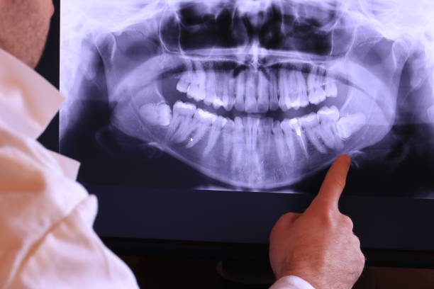 Best Chipped Tooth Repair Near Me  in Tunkhannock, PA